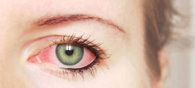 Глаз гноится но не болит