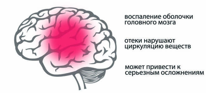 Постоянно болит голова и глаза подозрение на минингитовой инфекции