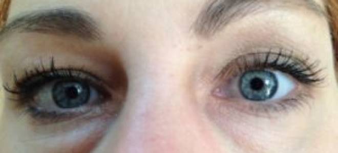 Что делать если болит мешок под глазом?