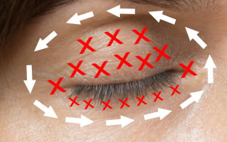 Сердце не болит а голова и отечность под глазами