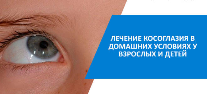 Как вылечить косоглазие в домашних условиях в 15 лет?