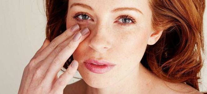 Что болит если темные круги под глазами?