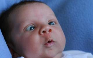 Как определить косоглазие у новорожденного?