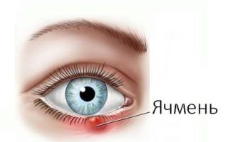 Ячмень на глазу лечение у детей лечение ячмень на глазу
