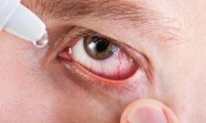 Как болят глаза при хламидиозе?