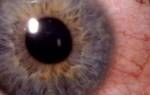 Конъюнктивит влияет ли на зрение