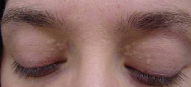 Болит сердце и слезятся глаза