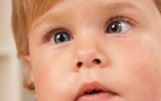 Как определить косоглазие у ребенка в 5 месяцев?