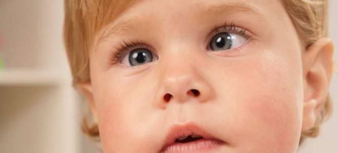 Как определить есть ли косоглазие у ребенка в домашних условиях?