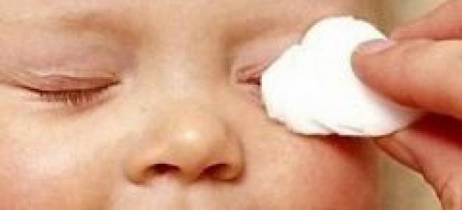 Психосоматика ячмень на глазу у ребенка