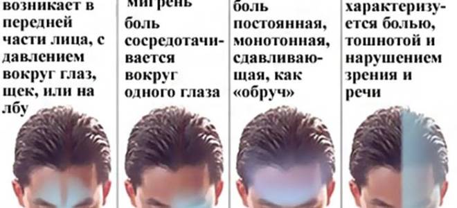 Болит голова в области виска слева и давит на глаз
