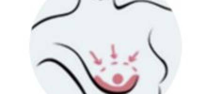 Может ли при катаракте болеть глаз