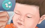 Как промыть глаза ребенку при конъюнктивите?
