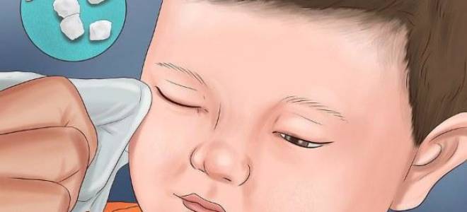 Чем можно промывать глаза при конъюнктивите ребенку