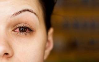 Что делать если покраснел глаз и болит после линз?