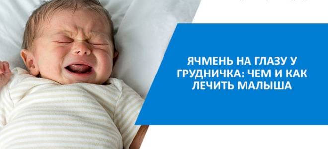 Чем лечить ячмень на глазу у ребенка до года