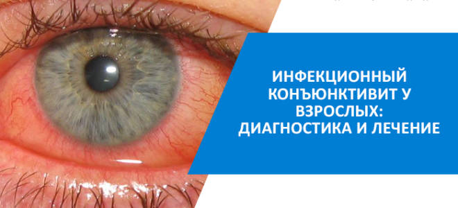 Конъюнктивит глаз это инфекционное заболевание