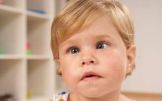 Остеопатия при косоглазии у детей