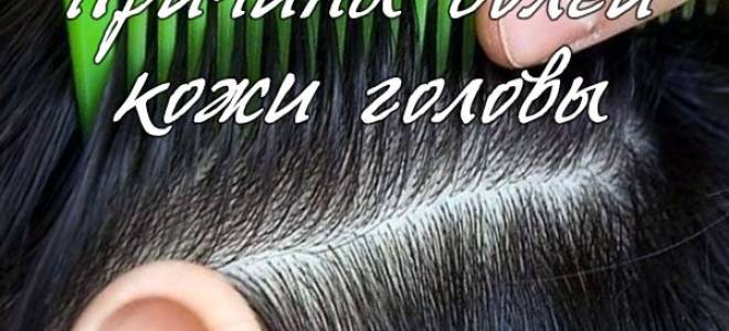 Болит кожа головы и глаза