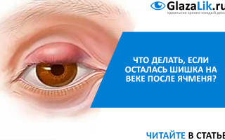 След после ячменя на глазу