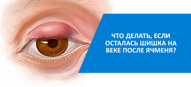 След после ячменя на глазу